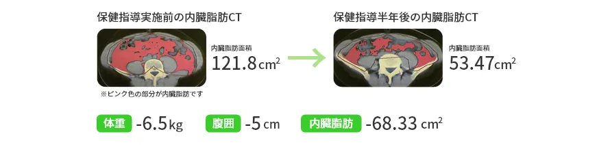 保健指導改善例